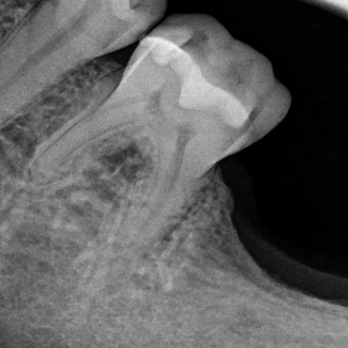 Shane Parish Drops Surprise Album, Dental Work, to Fund His Dental Care